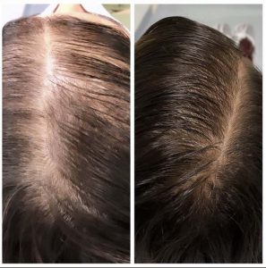 Gerenciando o Estresse: Um Aliado Poderoso contra a Queda - inspiração 2