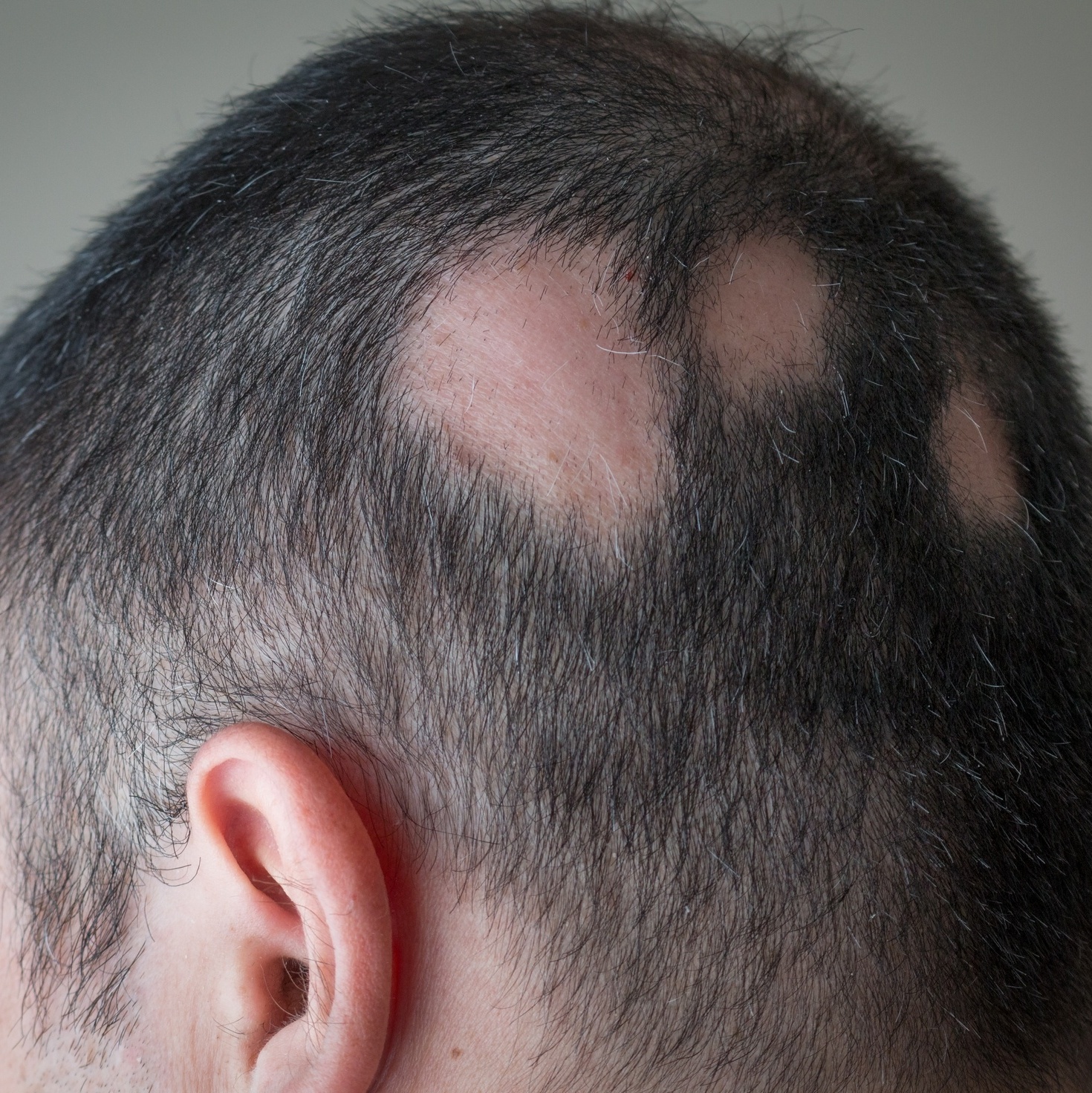 Terapias de Baixa Potência: Estimulando a Raiz dos Problemas - inspiração 2