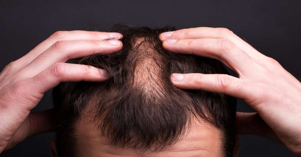 Nutrição e suplementação: O que seu cabelo precisa para crescer forte? - inspiração 1