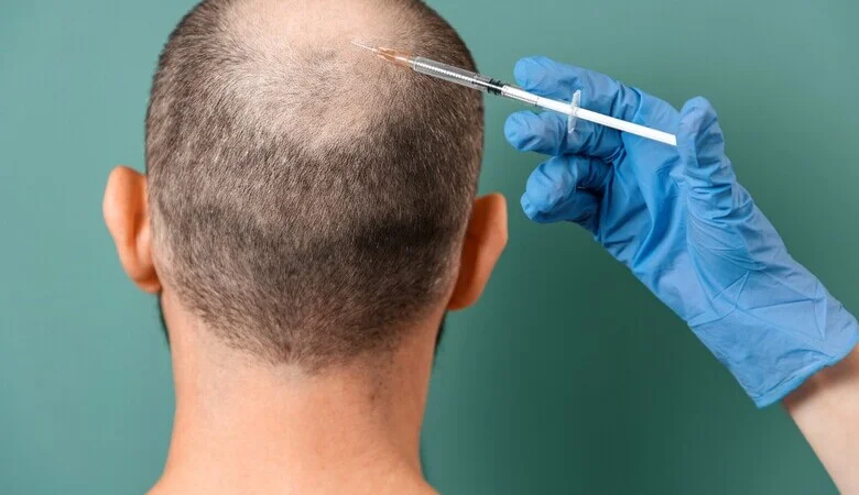 Nutrição e suplementação: O que seu cabelo precisa para crescer forte? - inspiração 2