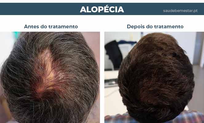 Cuidados diários com o couro cabeludo: Limpeza e hidratação adequadas - inspiração 2