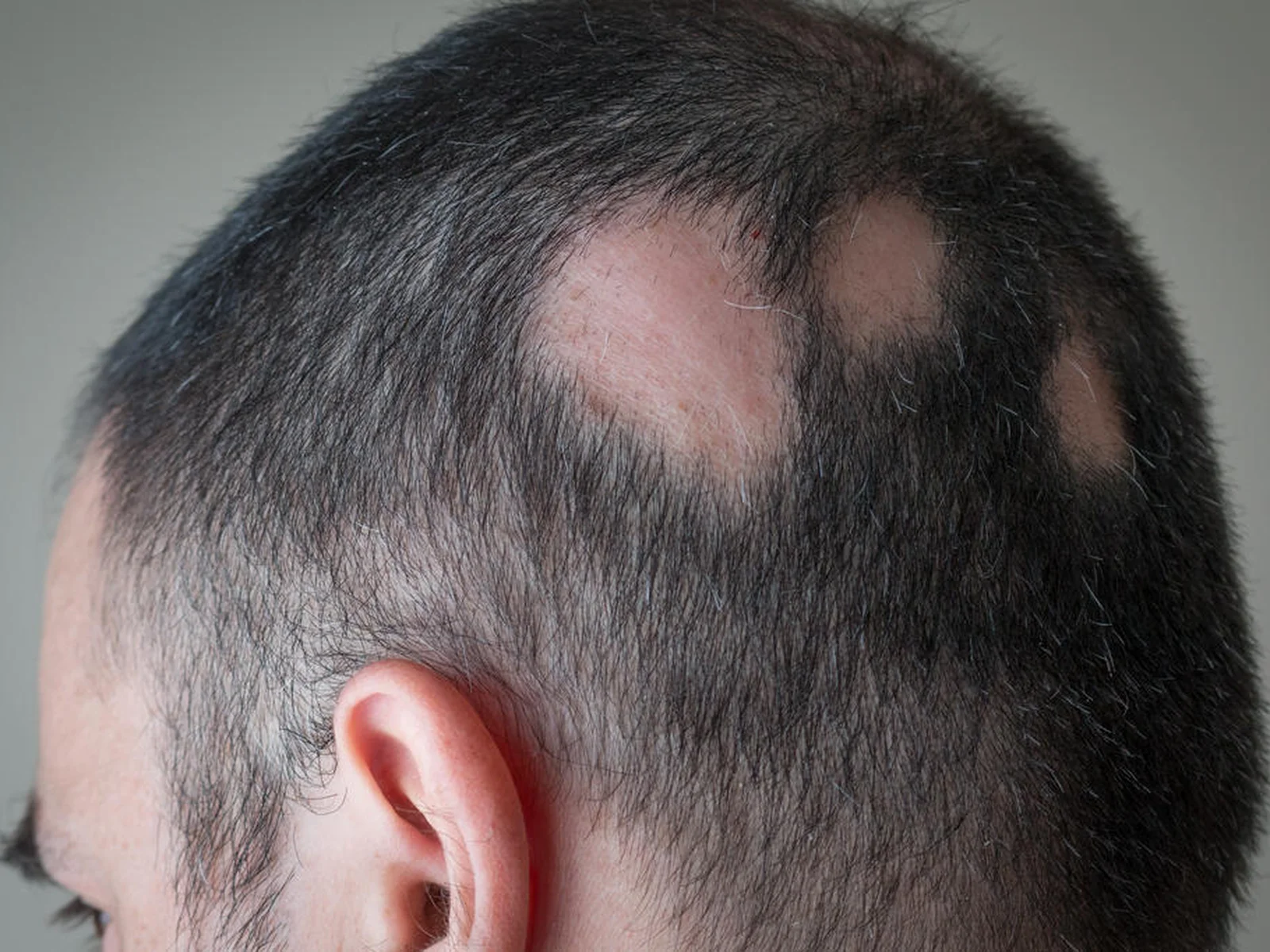 Identificando os gatilhos de estresse no seu dia a dia - inspiração 1