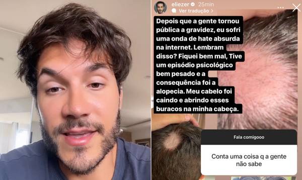 Nutrição capilar: o que seu cabelo realmente precisa? - inspiração 2