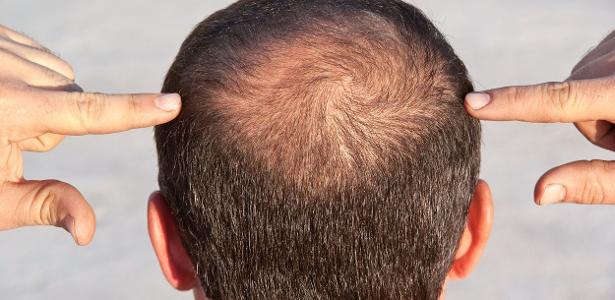 O poder dos óleos vegetais para o couro cabeludo - inspiração 1