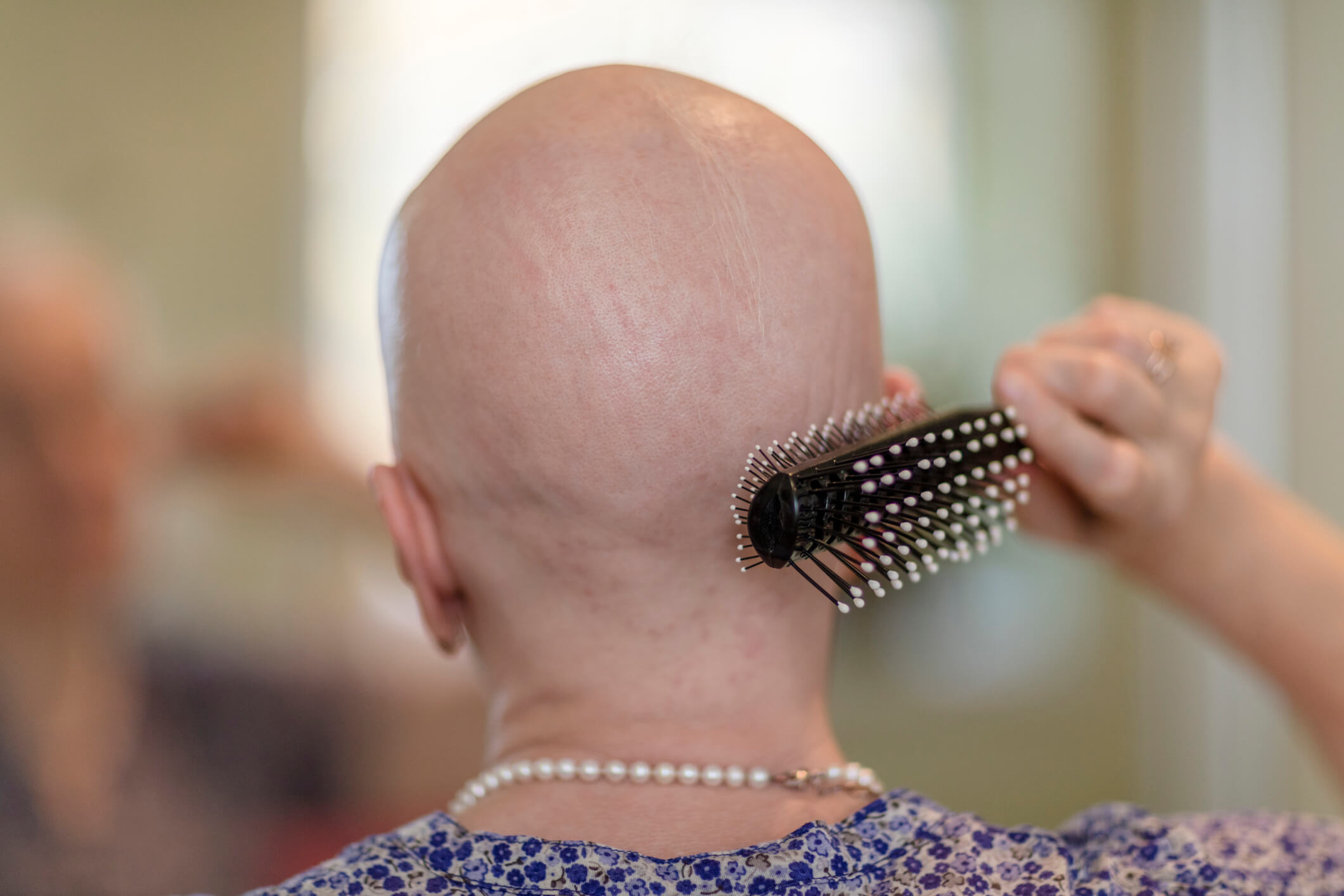 Evitando procedimentos químicos agressivos - inspiração 2