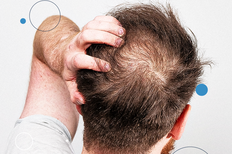 Vitaminas do Complexo B: Energia e Vitalidade para Seus Fios - inspiração 1