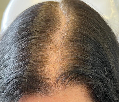 A Nutrição que Nutre Seu Couro Cabeludo de Dentro para Fora - inspiração 1