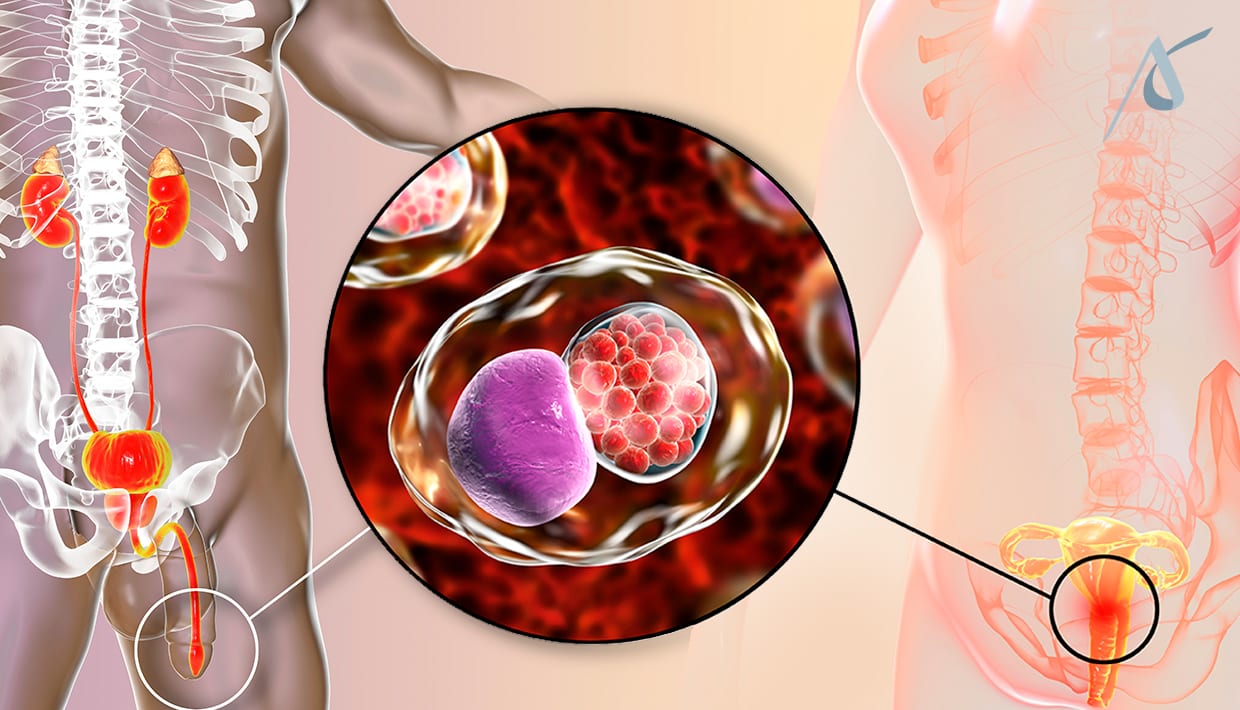 Conhecendo a Clamídia: O Que Você Precisa Saber - inspiração 2