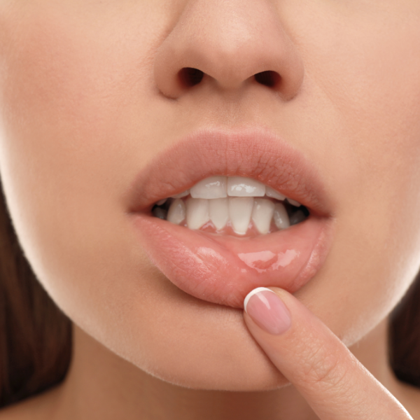 Comunicação Aberta Sobre Saúde Sexual - inspiração 1