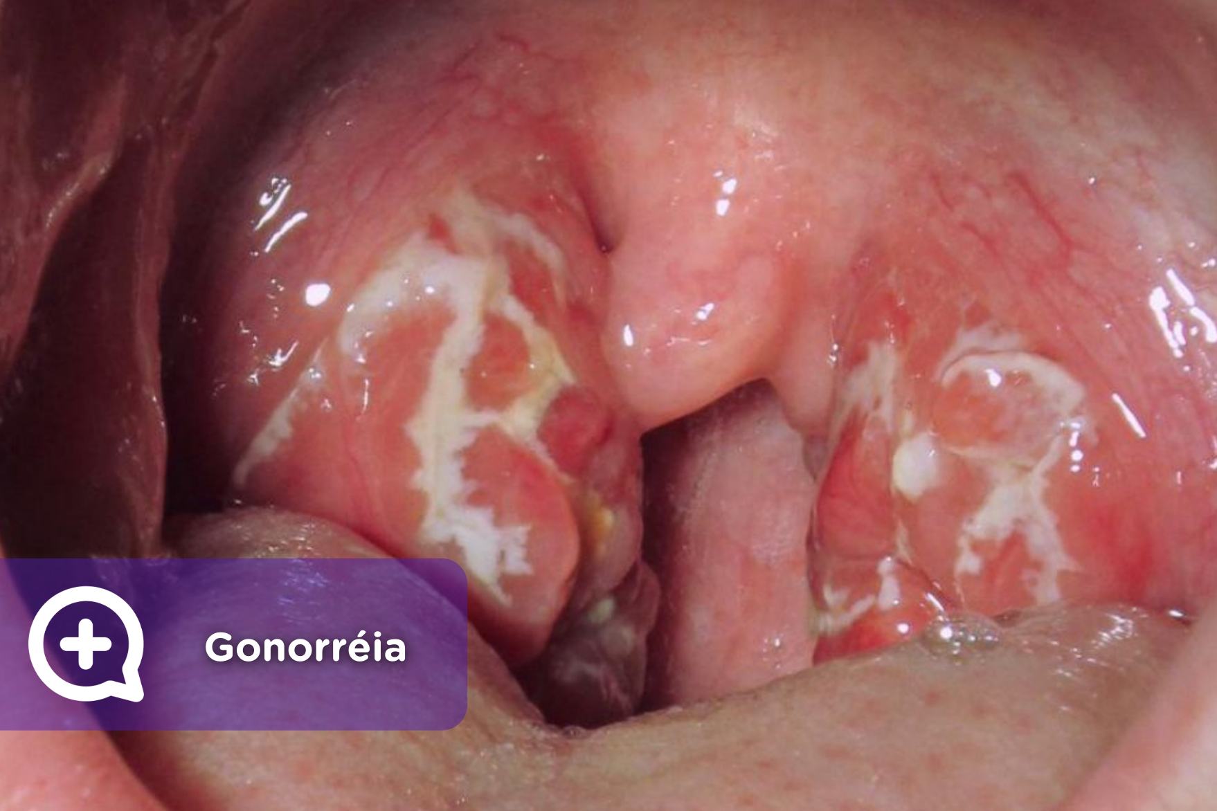 Testes Regulares: Seu Escudo de Proteção - inspiração 2