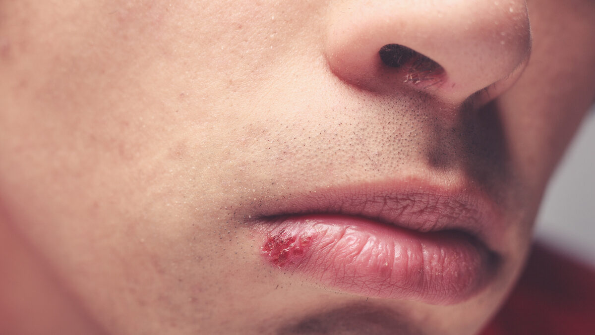 Conheça os Sintomas e Busque Ajuda Rápida - inspiração 1