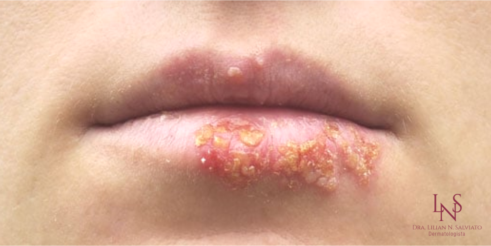 Evite Compartilhar Utensílios Pessoais: Uma Regra de Ouro - inspiração 2