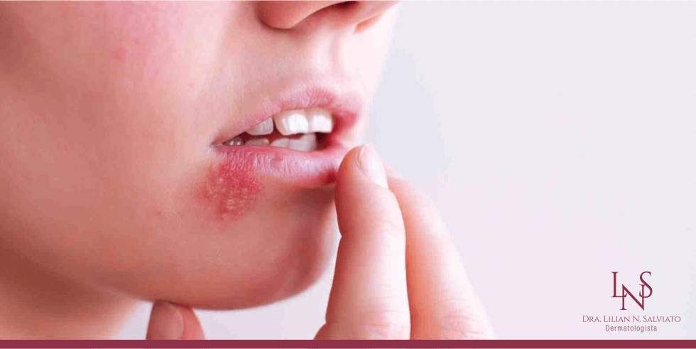 Cuidados com o Contato Direto: Beijos e Abraços Sob Controle - inspiração 2