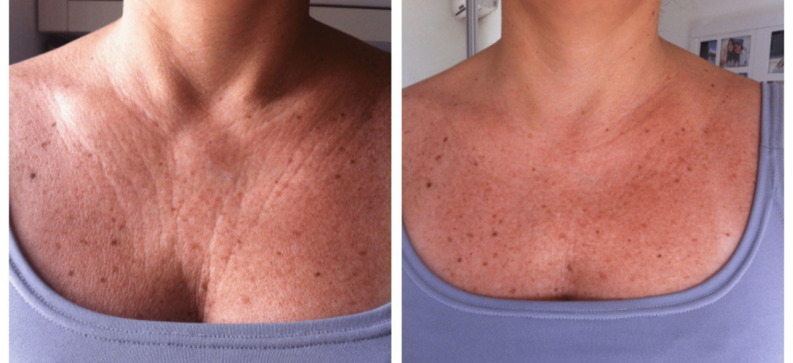 Proteção Solar Diária: O Escudo Essencial - inspiração 2