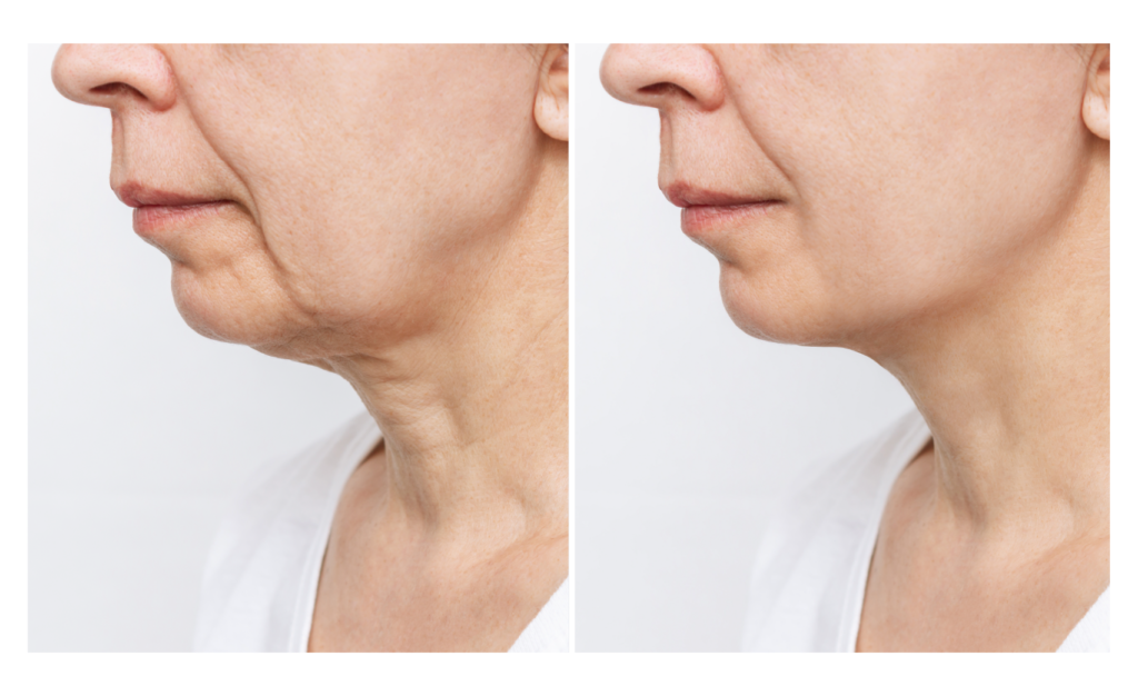 Hidratação Profunda: O Segredo da Elasticidade - inspiração 1