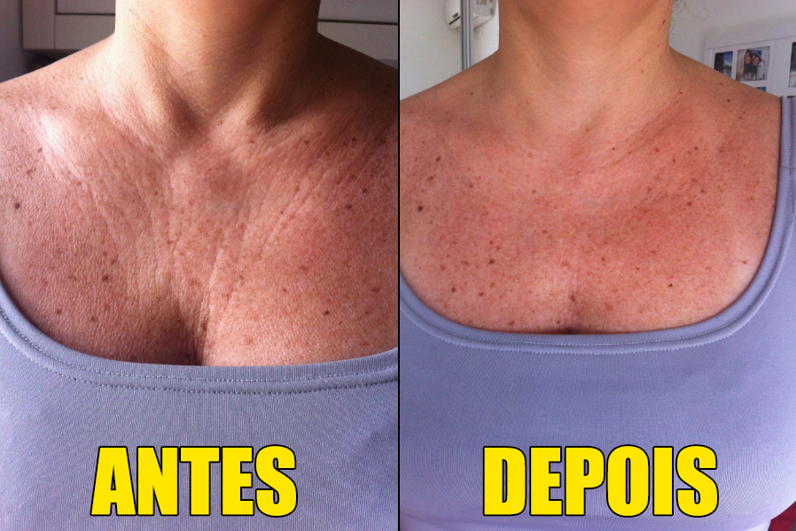 Hidratação Profunda: O Segredo da Elasticidade - inspiração 2