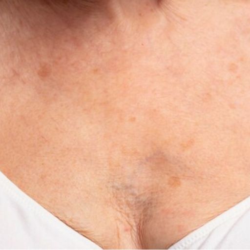 Roupas e Tecidos: Aliados ou Vilões? - inspiração 1