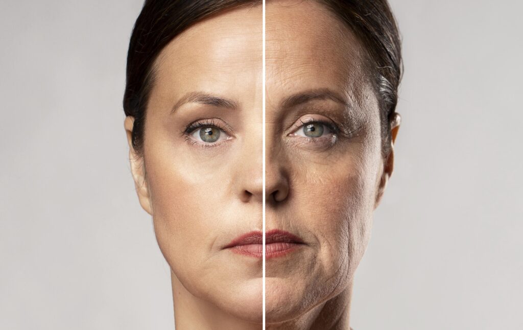 Exercícios faciais: tonificando a musculatura - inspiração 2