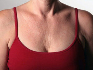 Limpeza Delicada: Removendo Impurezas sem Agredir - inspiração 1