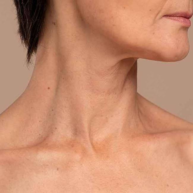 Limpeza Delicada: Removendo Impurezas sem Agredir - inspiração 2