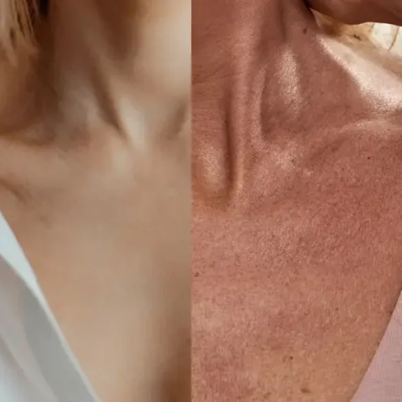 Alimentação e Hidratação Interna: Beleza de Dentro para Fora - inspiração 1