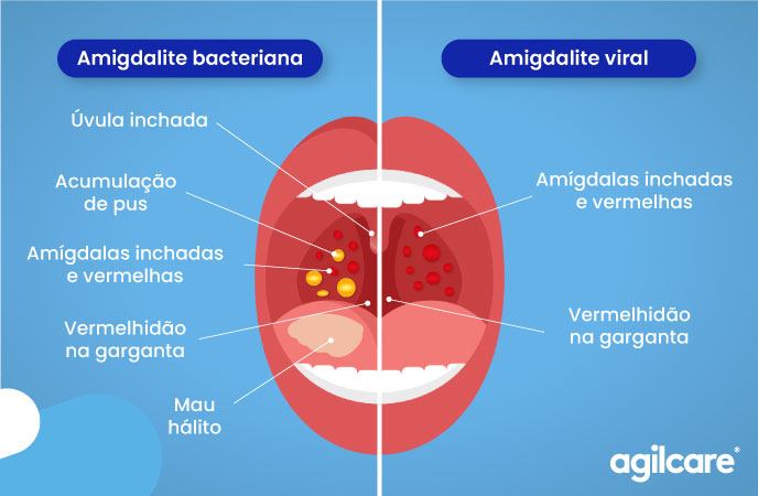 Prevenção de complicações: o que pode acontecer se não tratar? - inspiração 2