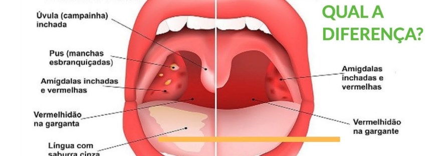 Alternativas de tratamento para casos recorrentes - inspiração 2