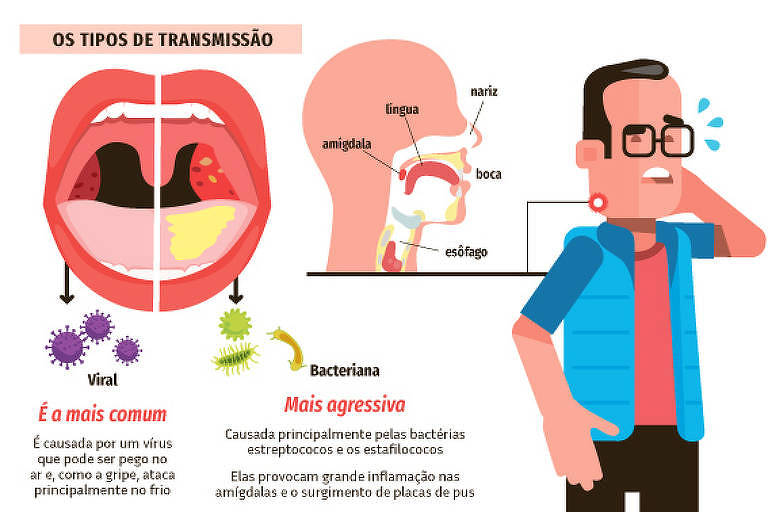 O Papel dos Antibióticos no Tratamento da Amigdalite - inspiração 2