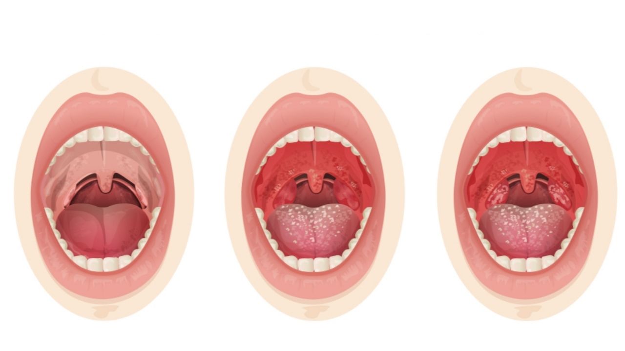 Alimentação Estratégica Durante a Recuperação - inspiração 2