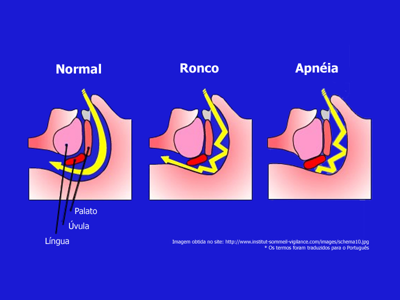 A Importância da Higiene do Sono: Rotinas Que Fazem a Diferença - inspiração 1