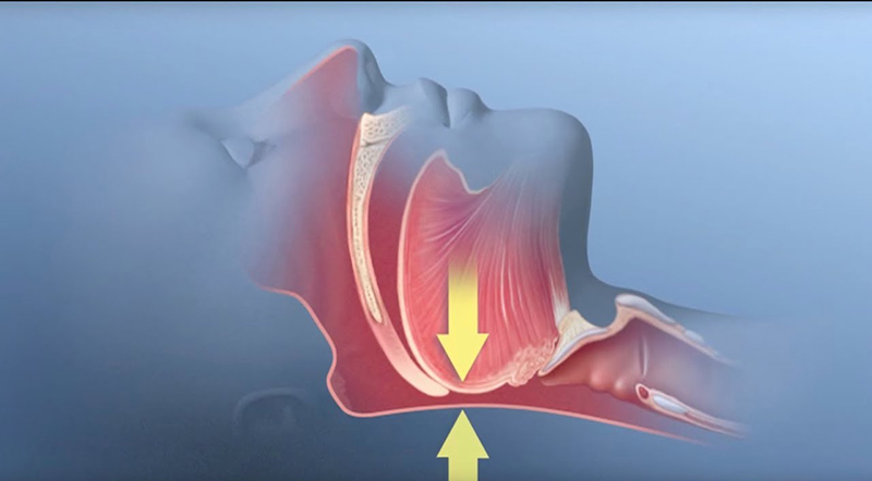 Exercícios Físicos: Movimento Que Melhora Sua Respiração Noturna - inspiração 1