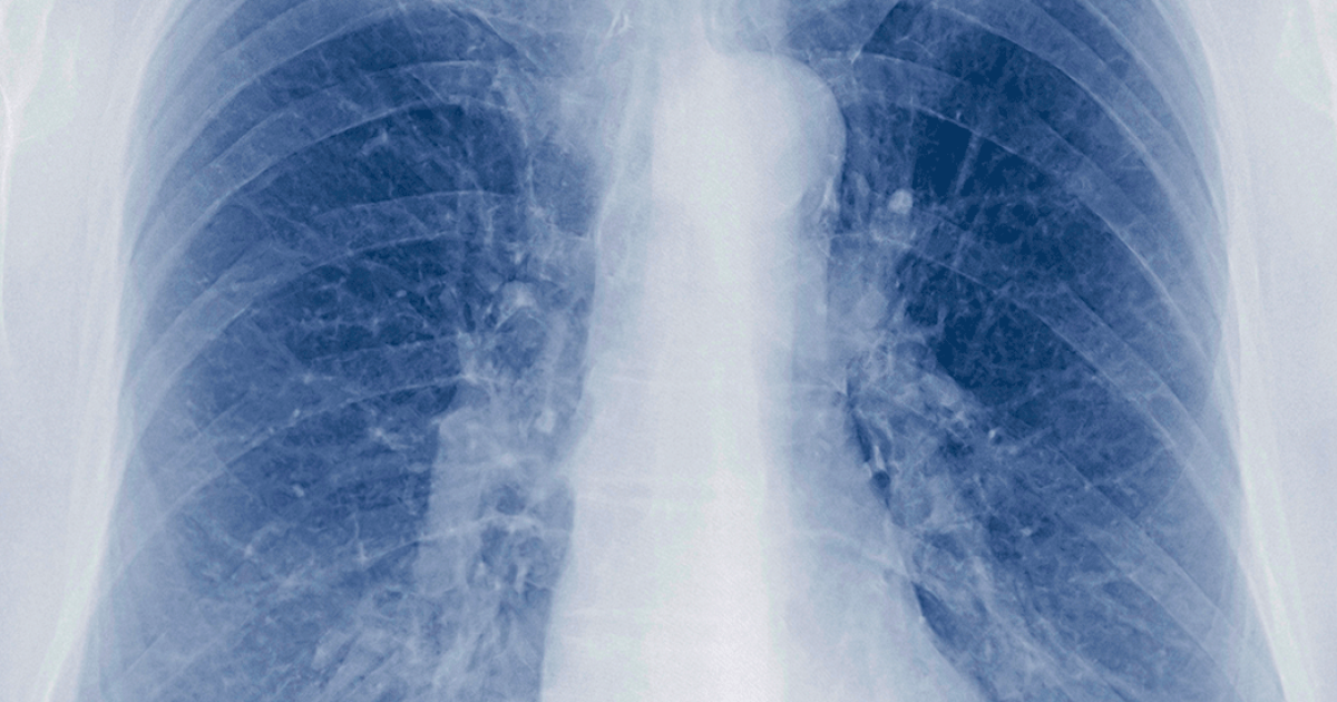 O Papel da Respiração na Recuperação - inspiração 1