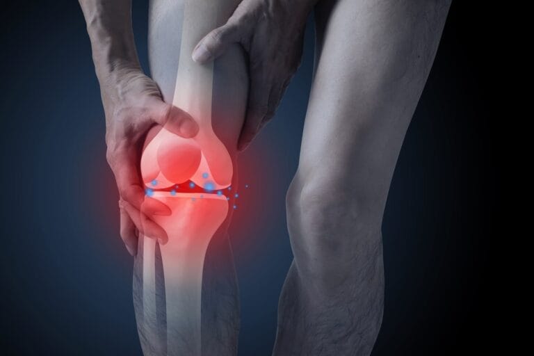 Prevenindo o Retorno da Bursite: Hábitos Essenciais - inspiração 2