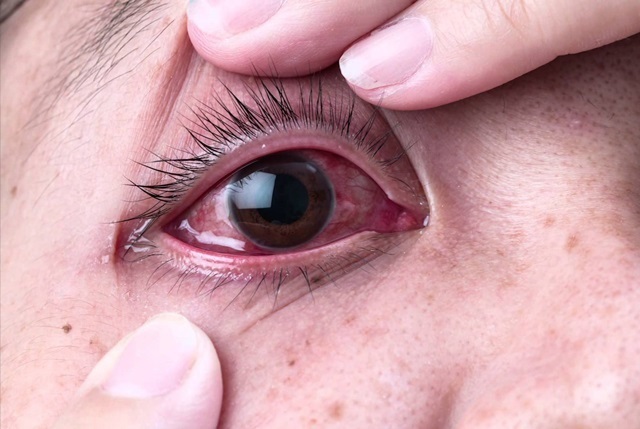 Repouso Visual: Dê um Respiro aos Seus Olhos - inspiração 1