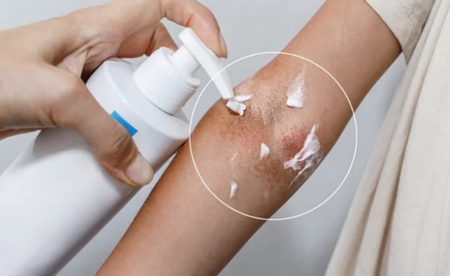 Evitando Gatilhos: Reconhecendo o Inimigo Invisível - inspiração 2