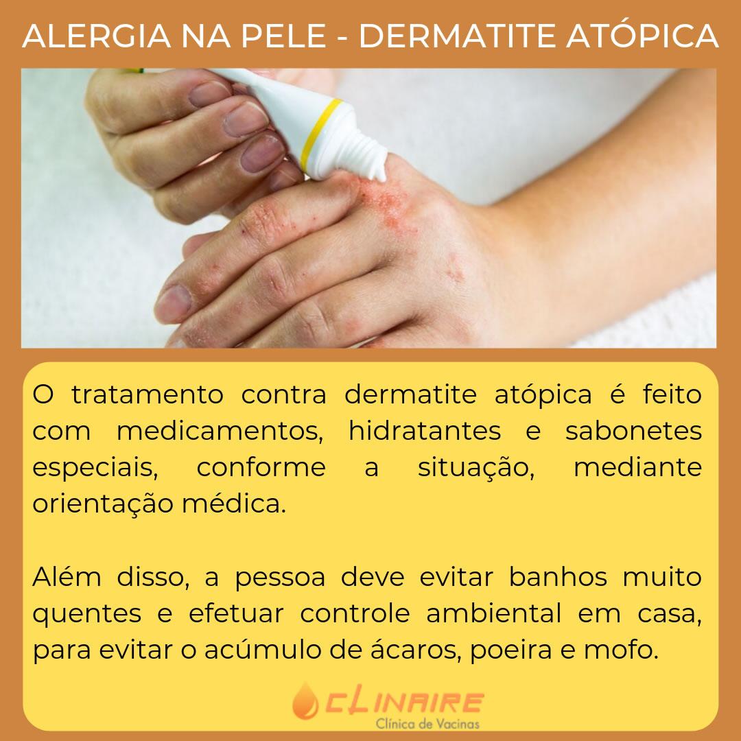 A Roupagem Certa: Conforto sem Irritação - inspiração 1