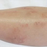 Prevenção é a Chave: Mudanças de Hábito para Evitar Recaídas - inspiração 1