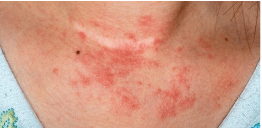 Prevenção é a Chave: Mudanças de Hábito para Evitar Recaídas - inspiração 2