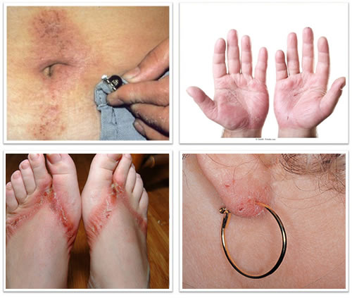 Compressas Frias: Refrescância que Acalma a Pele Irritada - inspiração 2