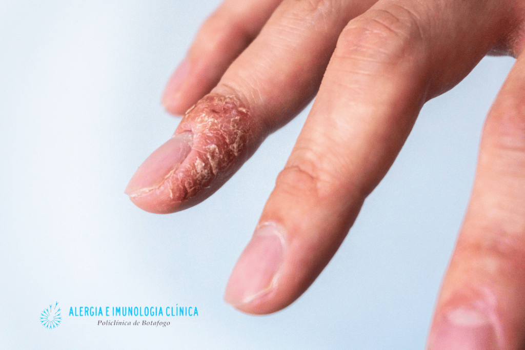 Quando Procurar um Dermatologista: Sinais de Alerta - inspiração 1