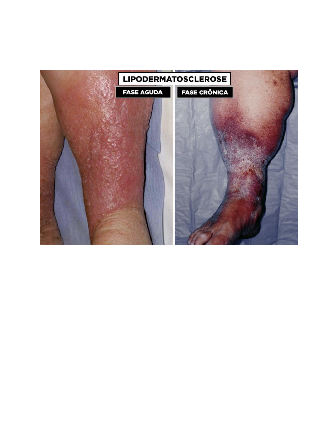 Acompanhamento profissional: A importância do dermatologista - inspiração 2