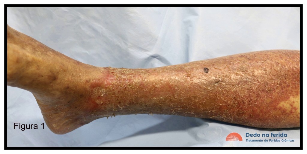 Movimento é vida: Exercícios simples para estimular a circulação - inspiração 2