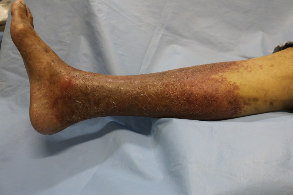 O uso de medicamentos tópicos: Quando e para quê - inspiração 2