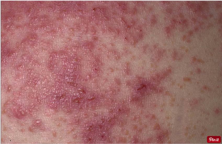 Alimentos a Evitar Rigorosamente: O Que Fica Fora do Cardápio - inspiração 1