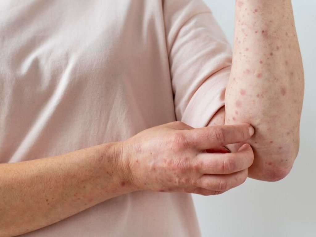 Suplementação Nutricional: O Papel das Vitaminas e Minerais - inspiração 1