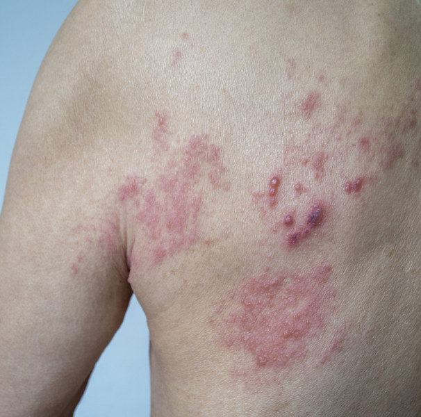 Acompanhamento Médico e Nutricional: Uma Parceria Indispensável - inspiração 2