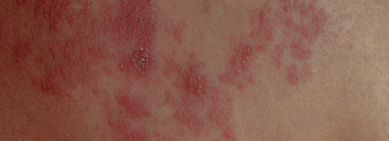 Buscando Apoio: Grupos e Recursos para Você - inspiração 1