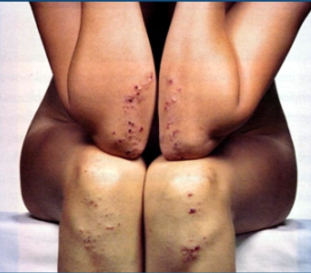 Buscando Apoio: Grupos e Recursos para Você - inspiração 2