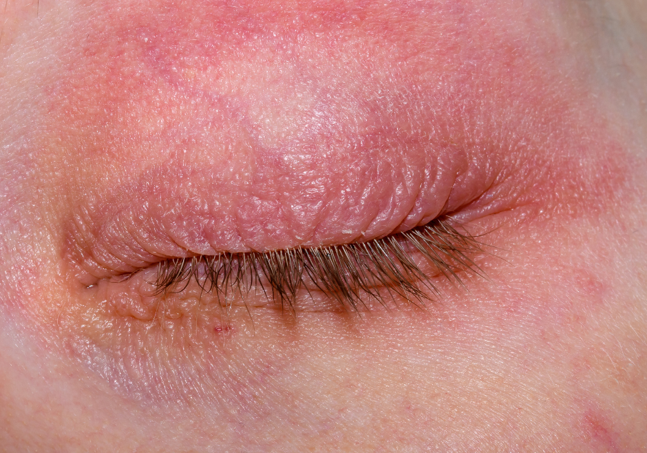 Identificando os Primeiros Sinais da DH Infantil - inspiração 2