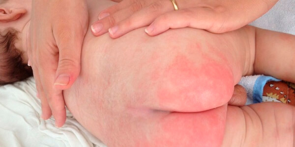 A Importância da Super-observação com Novos Alimentos - inspiração 1